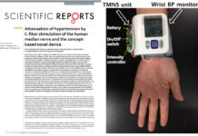 Will a Wearable Acupuncture Device Replace Hypertension Medicine?