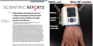 Will a Wearable Acupuncture Device Replace Hypertension Medicine?