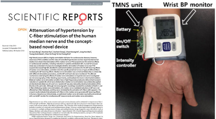 Will a Wearable Acupuncture Device Replace Hypertension Medicine?