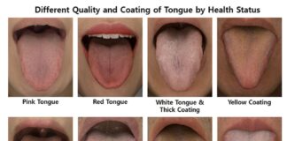 Upgraded Tongue Imaging Device for Diagnosis, Readied for Commercialization