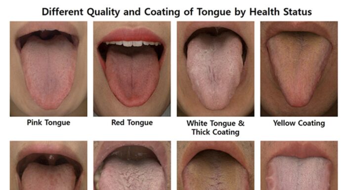 Upgraded Tongue Imaging Device for Diagnosis, Readied for Commercialization