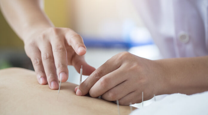 Bisoma Five-Element Acupuncture