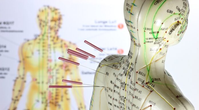 Underlying Theories of Acupuncture Treatment ③