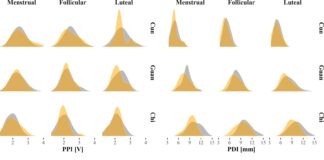 A Recent Research Opened Possibilities for Objective Pulse Diagnosis