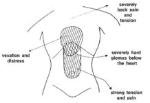 The Dynamics of Shang Han Lun ⑩ Particulars-Part 1