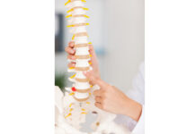 How to treat Spondylolysis