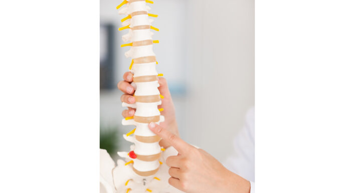 How to treat Spondylolysis