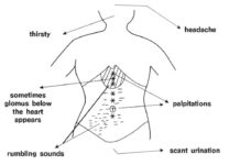 Sign Symptoms and Herbs-Sign Symptom by abdominal diagnosis 1-2