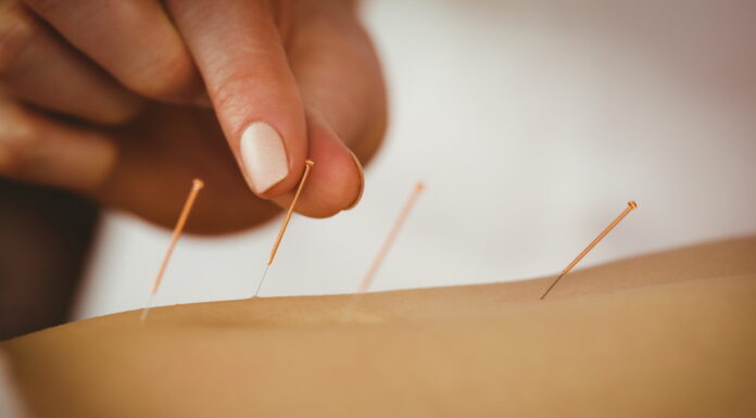 One Yin and One Yang Acupuncture Technique is the Gentlest Treatment