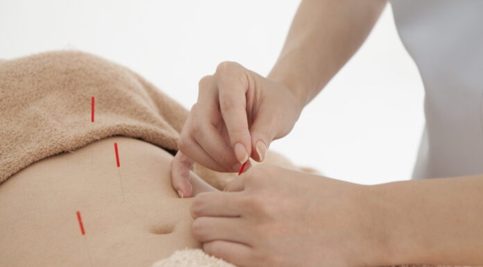 Acupuncture Treatment is More Effective on Early Stage of Obesity