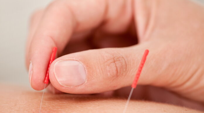 Underlying Theories of Acupuncture Treatment (15) How to Use Readjusting Yin and Yang Acupuncture Technique (陰陽調和取穴)