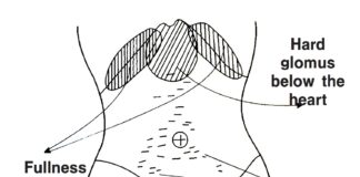 Fullness in the Chest and Rib-side (胸脇苦滿)