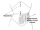 The Dynamics of Shang Han Lun ⑬ Particulars-Part 3 Pressure Pain on Left Below the Umbilicus (臍左下按壓痛)
