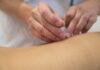 Acupuncture Treatment is Basic of Performing Asian Medicine