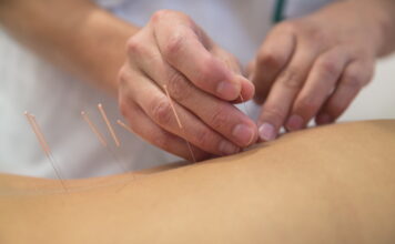 Acupuncture Treatment is Basic of Performing Asian Medicine