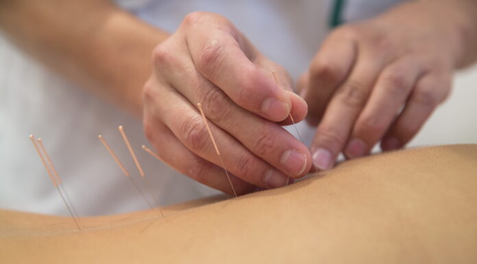 Acupuncture Treatment is Basic of Performing Asian Medicine