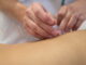 Acupuncture Treatment is Basic of Performing Asian Medicine