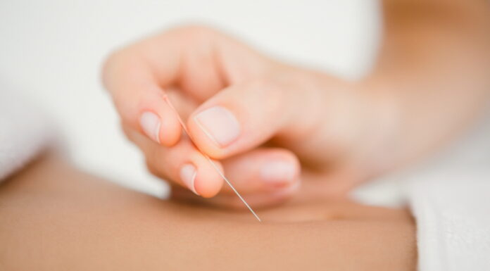 Underlying Theories of Acupuncture Treatment (19) Correlational Acupuncture Points (CAP) and Applications of CAPs