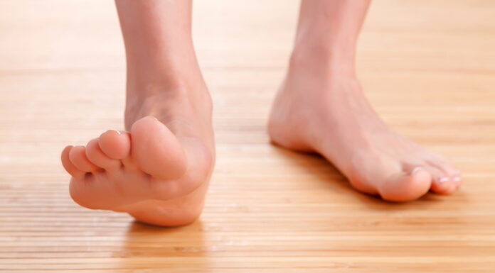 How to Treat Out-toeing Gait