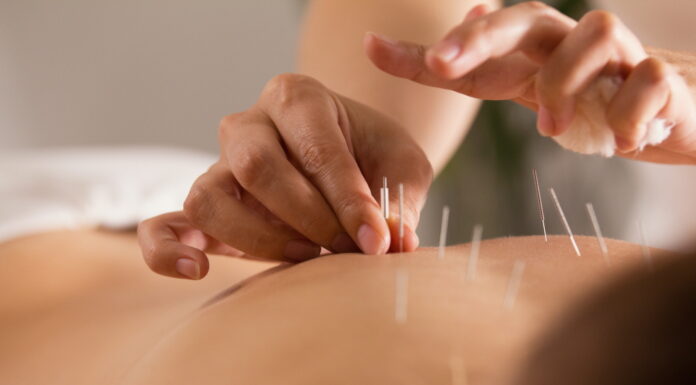 Using Alternative Acupuncture Points of Correlational Acupuncture Points in one meridian