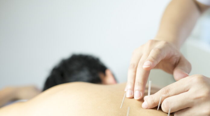 Lesser Number of Needle Insertion Leads to Better Treatment Effect