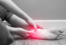 How to treat Plantar Fasciitis