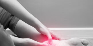 How to treat Plantar Fasciitis
