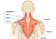 Target trapezius muscle to treat sore eye
