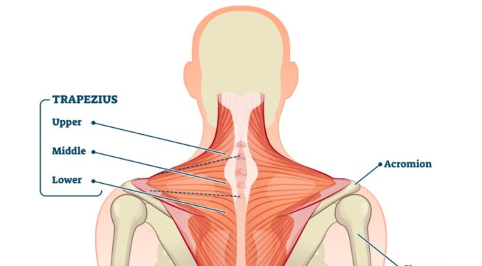 Target trapezius muscle to treat sore eye