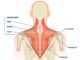 Target trapezius muscle to treat sore eye