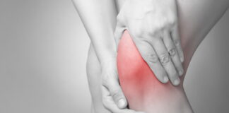 Rheumatoid Arthritis, benefits of acupuncture and herb