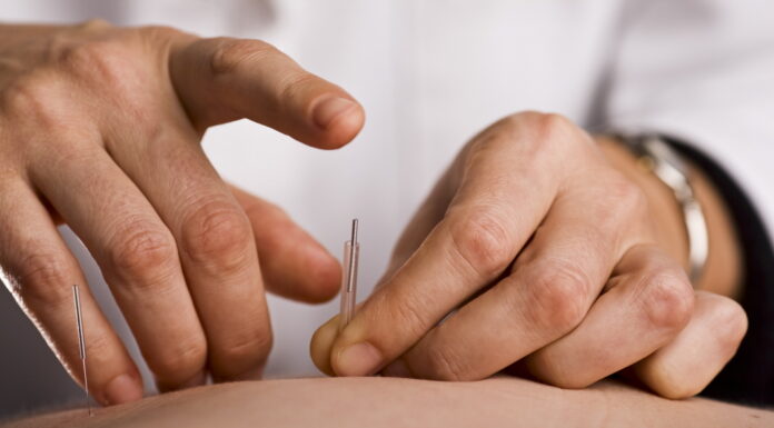 Acupuncture Treatment Was Effective to Lowering Blood Pressure Scientifically Proved