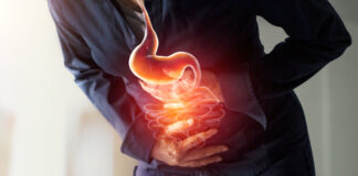 Suggestible treatments for digestion disorder