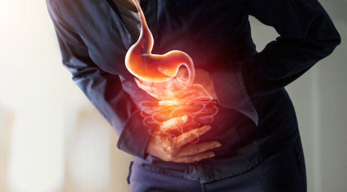 Suggestible treatments for digestion disorder