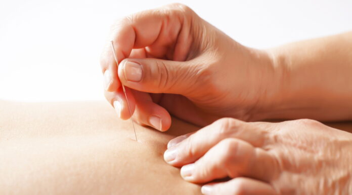 Underlying Theories of Acupuncture Treatment (26) Cleft Point Acupuncture for Acute Conditions