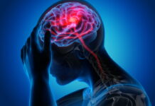 A Case of Acupuncture Treatment For Cerebral Infarction Patient