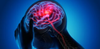 A Case of Acupuncture Treatment For Cerebral Infarction Patient