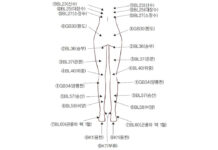 Applications of Chugoongtongrak Technique: Severe Paraplegia and knee pain without severe worn out of the knee cartridge