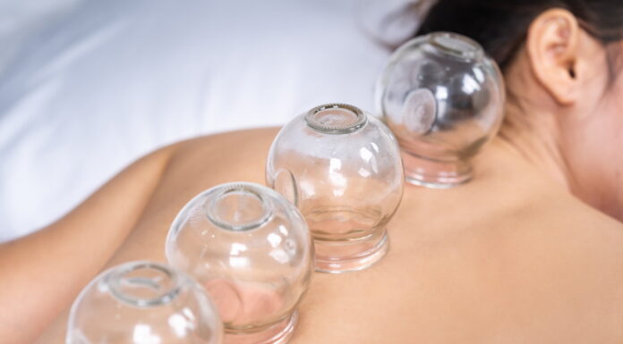 The effectiveness and safety of cupping therapy for stroke survivors: A systematic review and meta-analysis of randomized controlled trials ⑤ Results Ⅲ