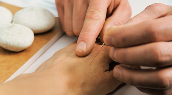 A Modern Clinical Approach of the TraditionalKorean Saam Acupuncture