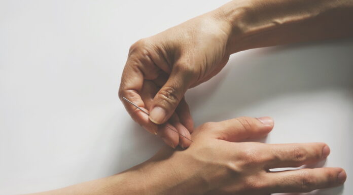 Underlying Theories of Acupuncture Treatment (36) Applying Cleft Points for Acute Symptoms