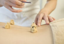 General Guide for Korean Acupuncture & Moxibustion (2)