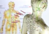 How to Minimize the Pain of the Acupuncture