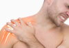 Acupuncture Could Help Failed Arthroscopic Repair