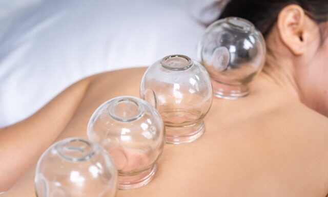 Cupping for Treating Pain: A Systematic Review