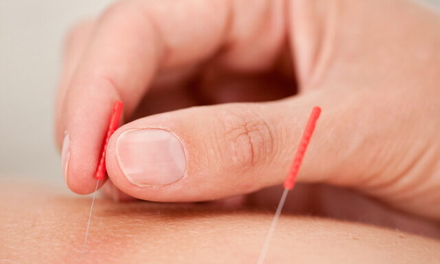 General Guide for Korean Acupuncture & Moxibustion (4) Saam Acupuncture & Taegeuk Acupuncture