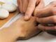 Developments in Korean Acupuncture (3)