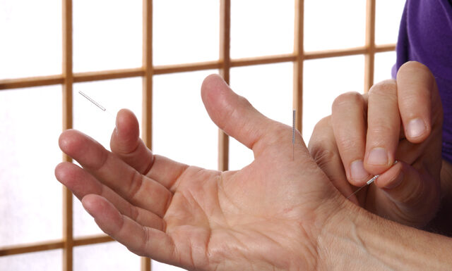 Introduction of Saam acupuncture (Four Points Acupuncture)