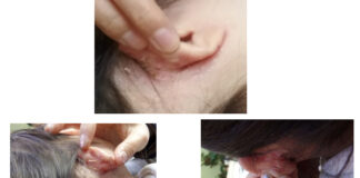 Huang Qi controls sweating, edema, and stamina