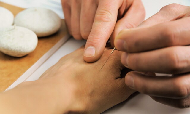 Clinical Application of Saam acupuncture (Four Points Acupuncture)
